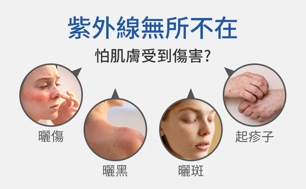 UV100 防曬重要性：紫外線對皮膚造成的曬傷、曬黑、曬斑與過敏傷害圖解。